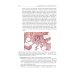 Патологическая анатомия: Учебник: В 2 т. Т. 2: Частная патология.  2-е изд., доп