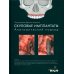 Скуловые имплантаты. Анатомический подход Скуловые имплантаты. Анатомический подход