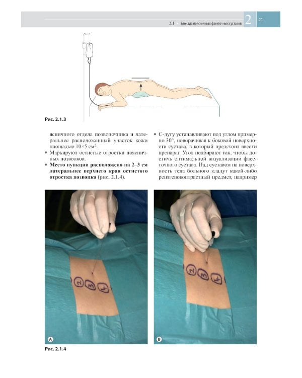 Атлас по инъекционным методам лечения боли. 2-е изд