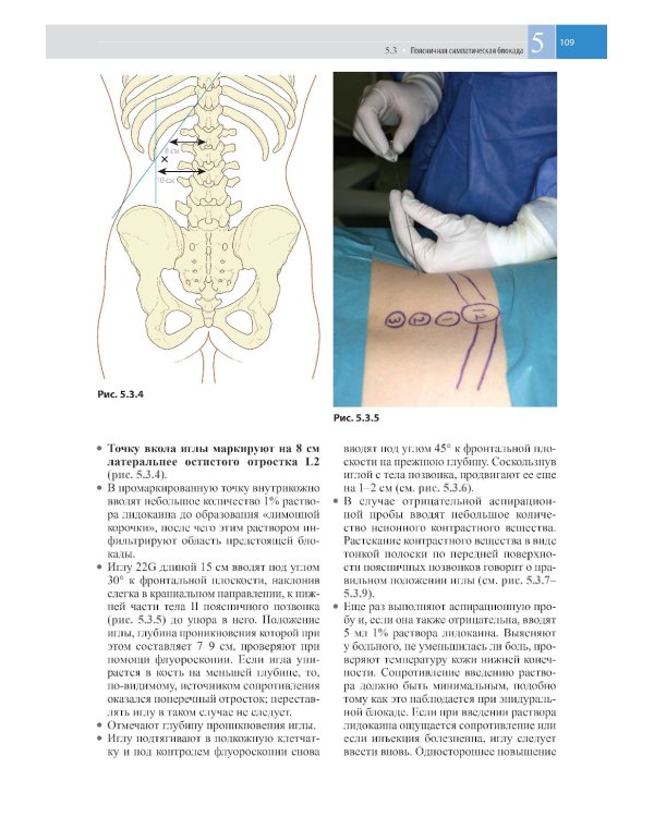 Атлас по инъекционным методам лечения боли. 2-е изд