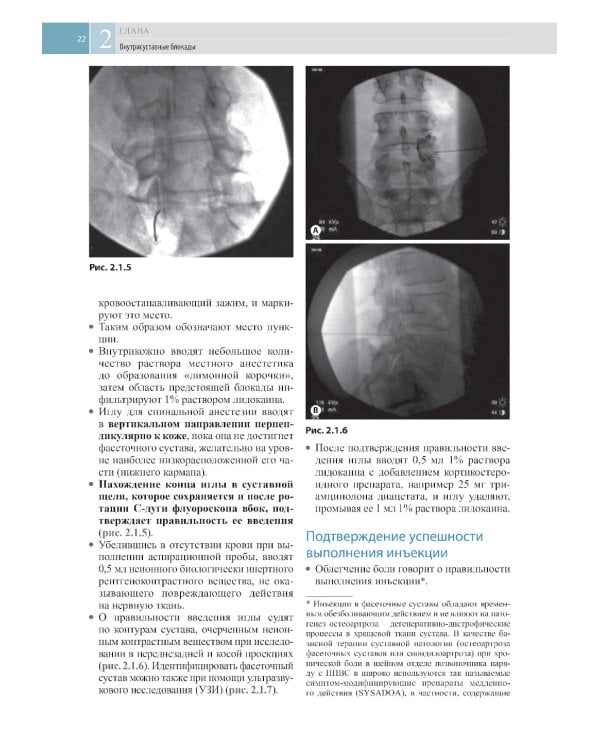 Атлас по инъекционным методам лечения боли. 2-е изд