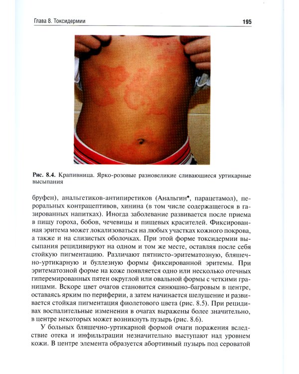 Детская дерматовенерология: Учебник