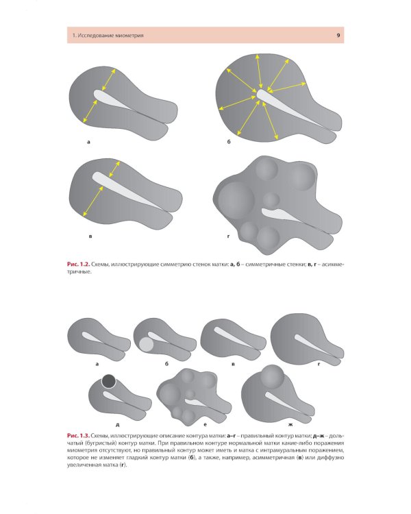 Стандартизация ультразвукового исследования миометрия и эндометрия (MUSA, IETA): Учебное пособие. 2-е изд