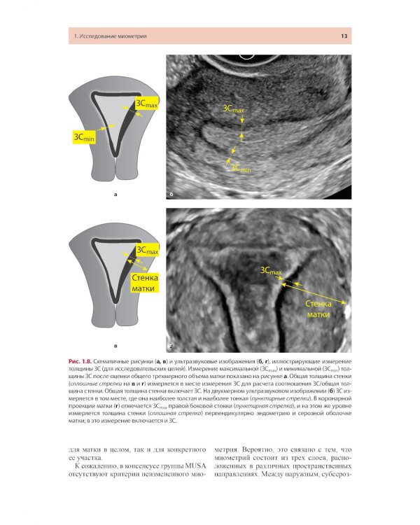 Стандартизация ультразвукового исследования миометрия и эндометрия (MUSA, IETA): Учебное пособие. 2-е изд
