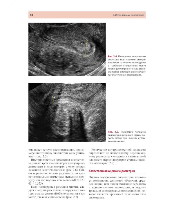 Стандартизация ультразвукового исследования миометрия и эндометрия (MUSA, IETA): Учебное пособие. 2-е изд