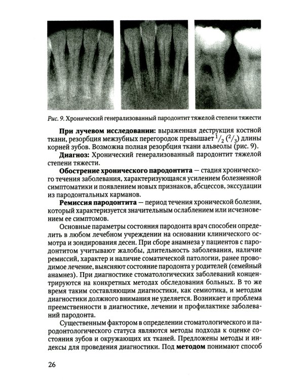 Диагностика пародонтита: Учебное пособие