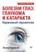 Болезни глаз: глаукома и катаракта. Карманный справочник