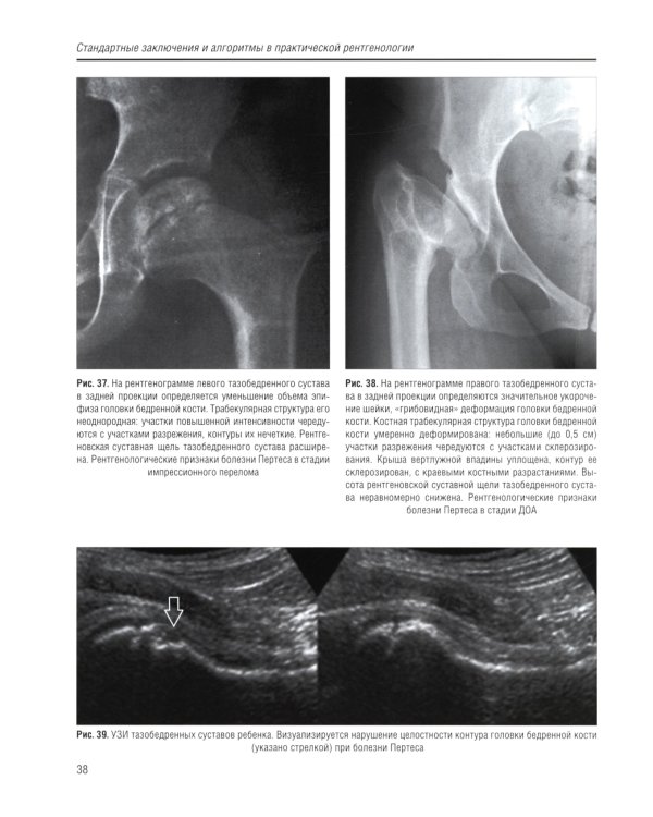 Стандартные заключения и алгоритмы в практической рентгенологии: Учебное пособие. 3-е изд