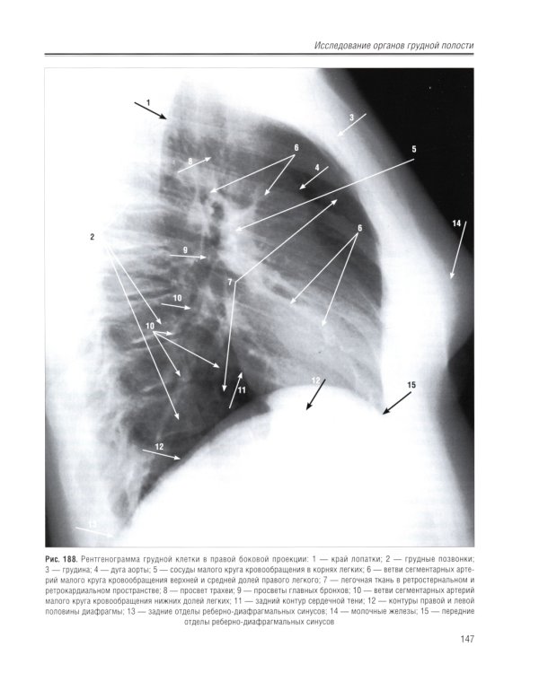 Стандартные заключения и алгоритмы в практической рентгенологии: Учебное пособие. 3-е изд