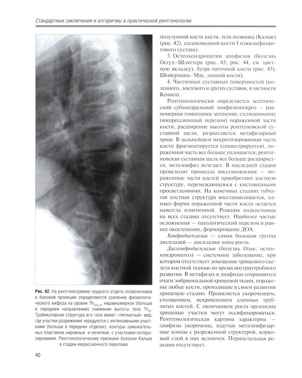 Стандартные заключения и алгоритмы в практической рентгенологии: Учебное пособие. 3-е изд