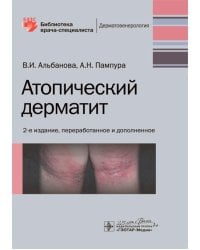 Атопический дерматит. 2-е изд., перераб. и доп