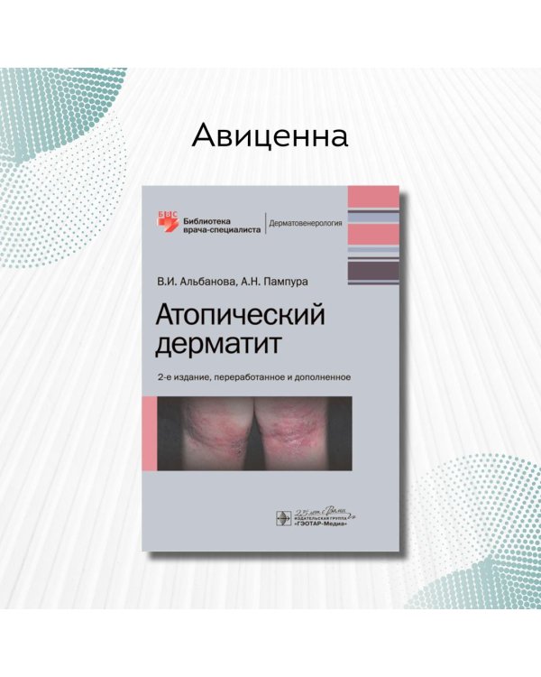 Атопический дерматит