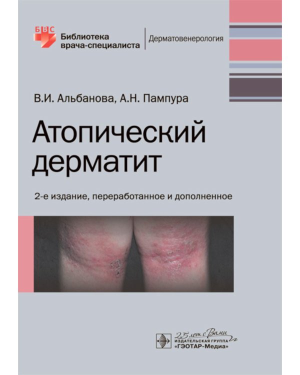 Атопический дерматит