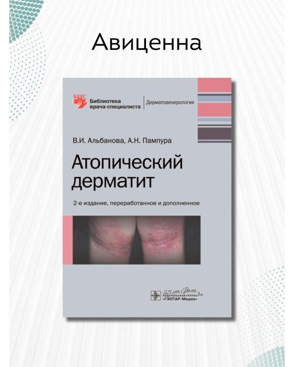 Атопический дерматит