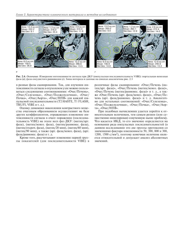 МРТ-диагностика очаговых заболеваний печени