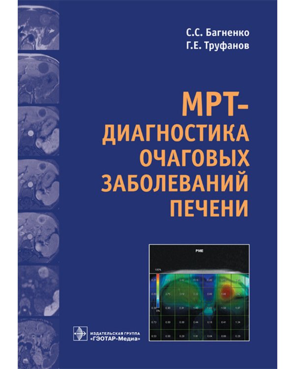 МРТ-диагностика очаговых заболеваний печени