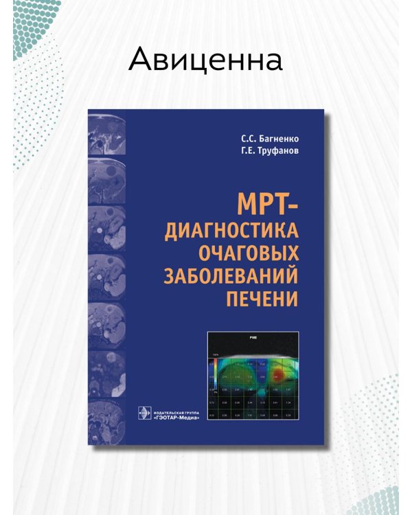 МРТ-диагностика очаговых заболеваний печени