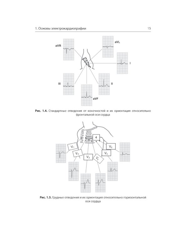Интерпретация ЭКГ в клинической практике