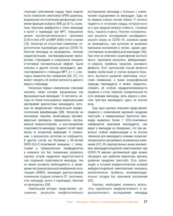 Миокардит в период пандемии SARS-CoV-2