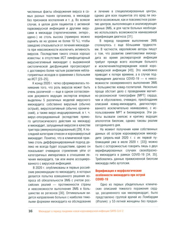 Миокардит в период пандемии SARS-CoV-2