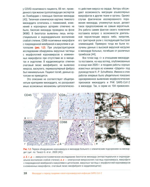 Миокардит в период пандемии SARS-CoV-2