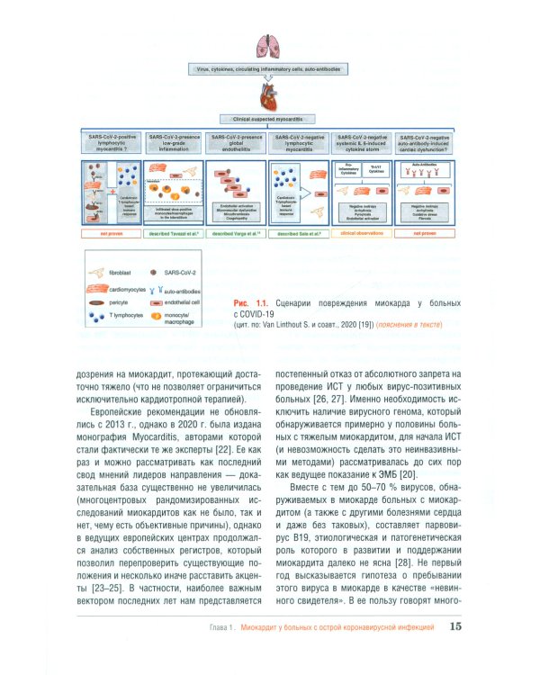 Миокардит в период пандемии SARS-CoV-2