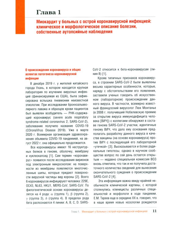 Миокардит в период пандемии SARS-CoV-2