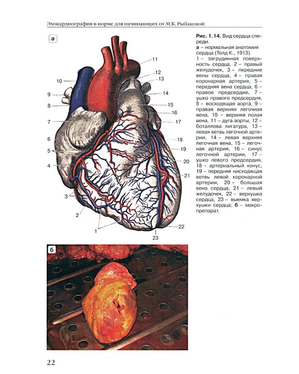 Эхокардиография в норме для начинающих от М.К. Рыбаковой