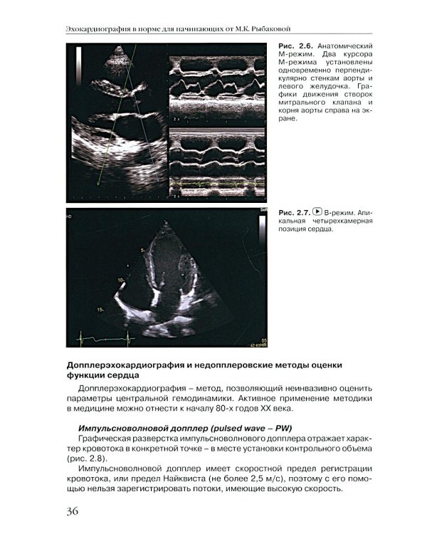 Эхокардиография в норме для начинающих от М.К. Рыбаковой