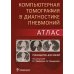 Компьютерная томография в диагностике пневмоний. Атлас: руководство для врачей