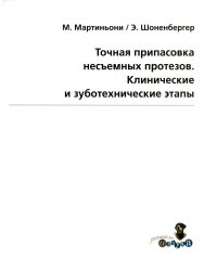 Точная припасовка несъемных протезов. Клинические и зуботехнические этапы