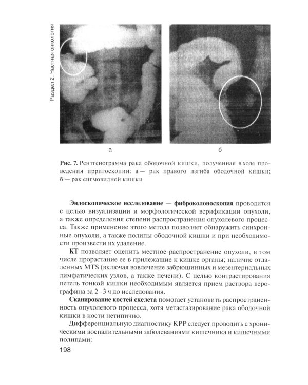 Онкология. Учебник. 2-е изд., перераб.и доп
