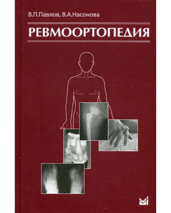 Ревмоортопедия. 3-е изд