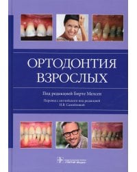 Ортодонтия взрослых