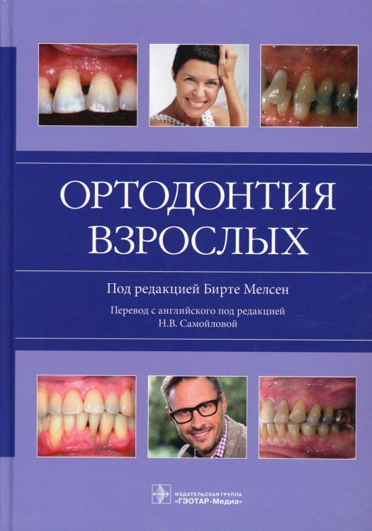 Ортодонтия взрослых Ортодонтия взрослых