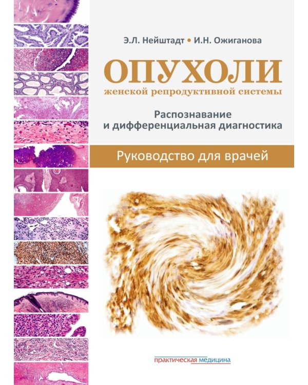 Опухоли женской репродуктивной системы. Распознавание и дифференциальная диагностика. Руководство для врачей