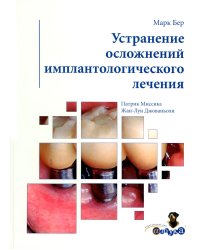 Устранение осложнений имплантологического лечения