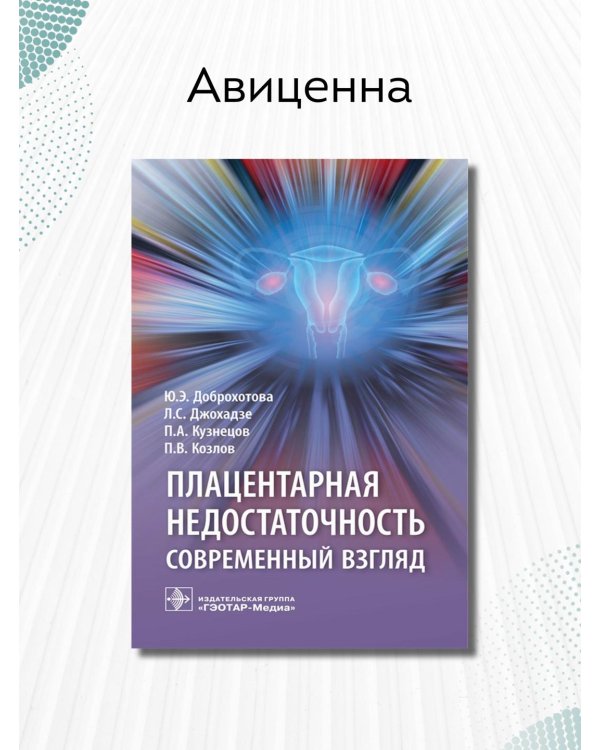 Плацентарная недостаточность. Современный взгляд