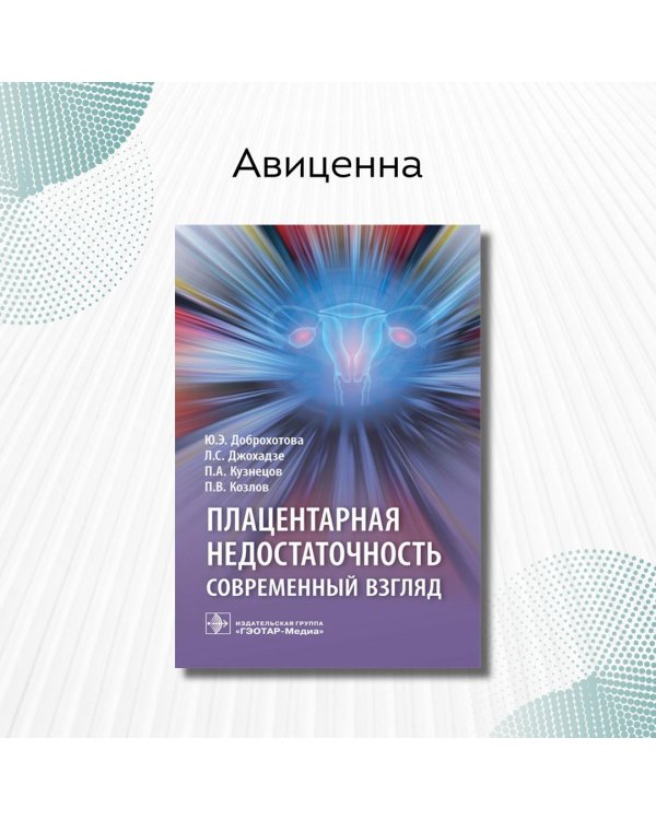 Плацентарная недостаточность. Современный взгляд