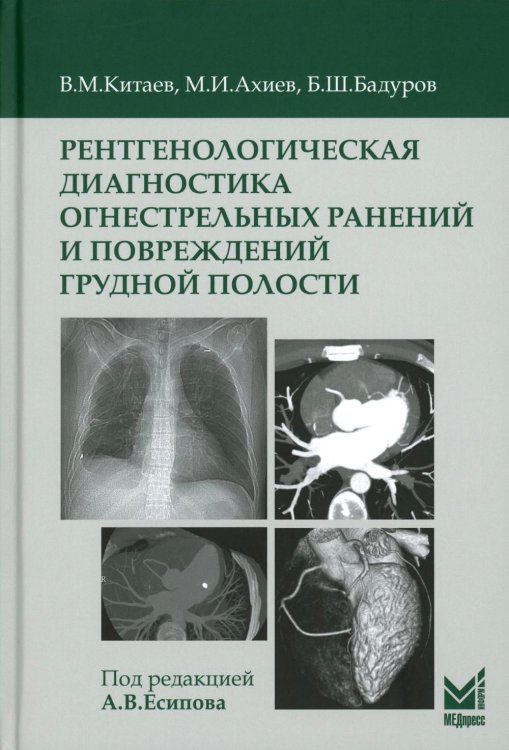 Рентгенологическая диагностика огнестрельных ранений и повреждений грудной полости. 2-е изд., перераб. и доп