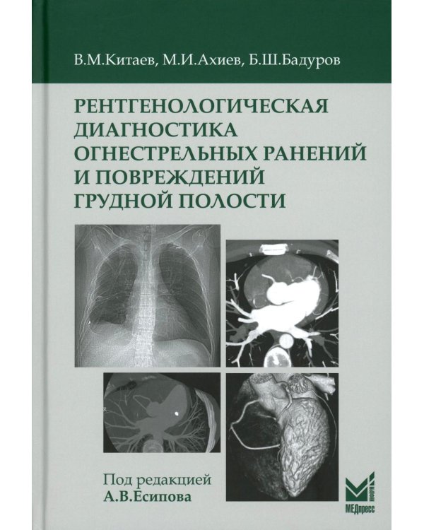 Рентгенологическая диагностика огнестрельных ранений и повреждений грудной полости. 2-е изд., перераб. и доп
