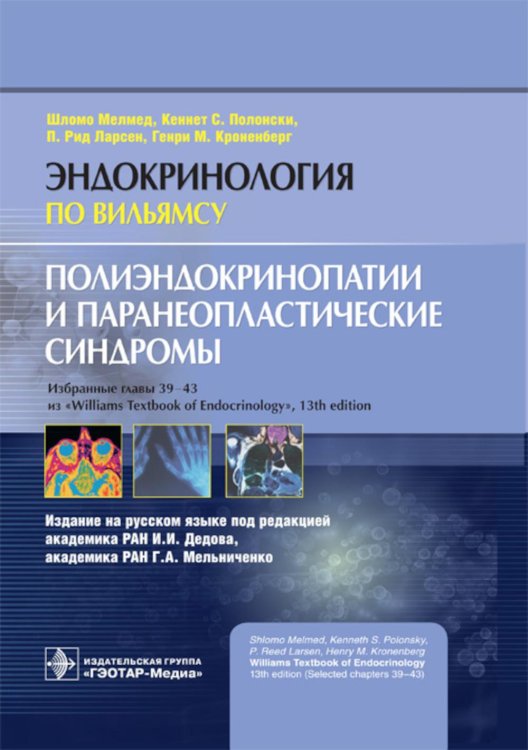 Эндокринология по Вильямсу Полиэндокринопатии и паранеопластические синдромы