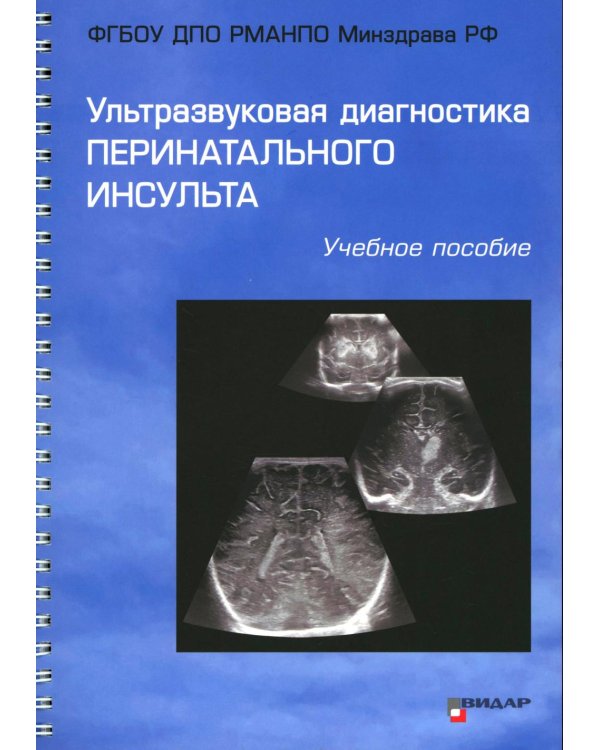 Ультразвуковая диагностика перинатального инсульта: Учебное пособие