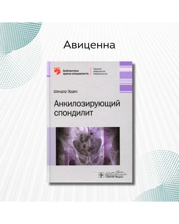 Анкилозирующий спондилит