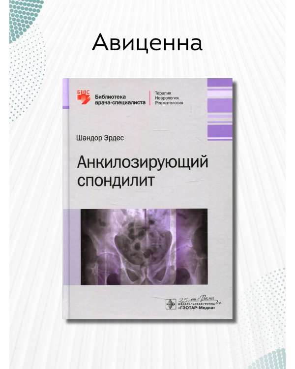 Анкилозирующий спондилит
