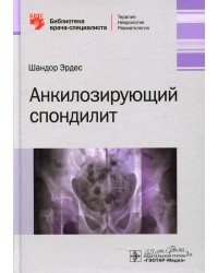 Анкилозирующий спондилит