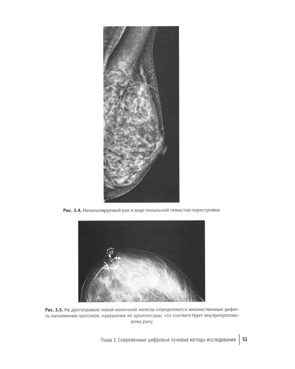 Медицинская логистика выявления рака молочной железы. Руководство для врачей