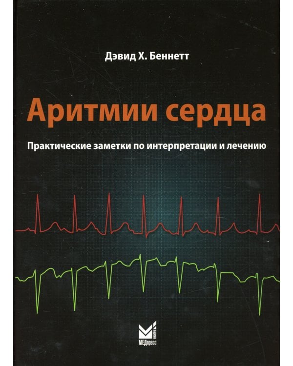 Аритмии сердца. Практические заметки по интерпретации и лечению