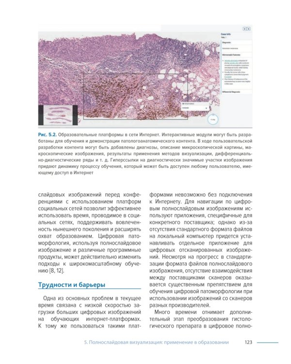 Цифровая патоморфология