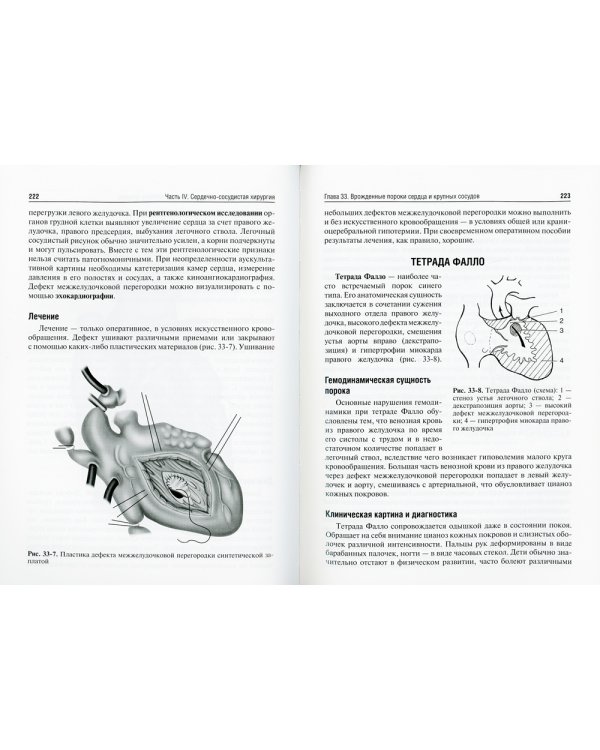 Хирургические болезни: Учебник. В 2 т. Т. 2. 2-е изд., перераб. и доп